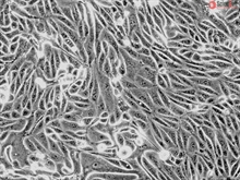 Human Renal Cortical Epithelial Cells, Passage 1