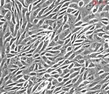 Cryopreserved Human Renal Epithelial Cells, Passage 1