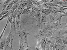 Human Renal Mesangial Cells, Passage 1