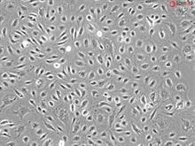 Human Bladder Microvascular Endothelial Cells, Passage 1