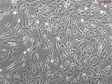 Human human Bladder Smooth Muscle Cells (HBdSMCs), Passage 1