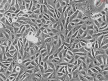 Human Urothelial Cells (HUC), Passage 1