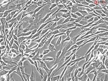 Human Bladder Stromal Fibroblasts