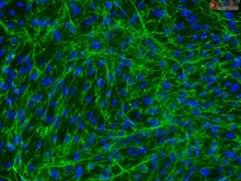 Human Bladder Stromal Fibroblasts