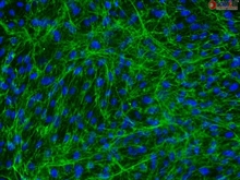 Human Bladder Stromal Fibroblasts