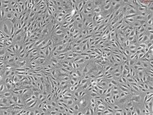 Human Prostate Microvascular Endothelial Cells, Passage 1