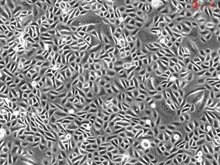 Human Primary Prostate Epithelial Cells, Passage 1