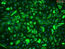 Human Primary Prostate Epithelial Cells, Passage 1