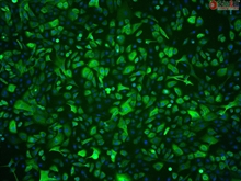 Human Primary Prostate Epithelial Cells, Passage 1