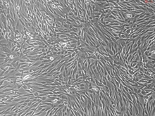 Human Prostate Fibroblasts