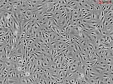 Human Seminal Vesicle Microvascular Endothelial Cells, Passage 1