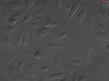 Human Leydig Cells (HLC), Passage 1