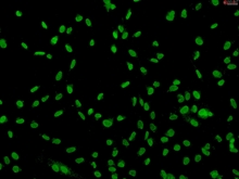 Human Sertoli Cells, Passage 1