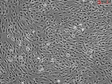 Human Calvarial Osteoblasts