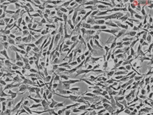 Human Osteoblasts-femoral