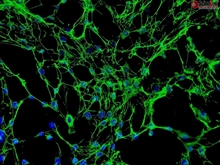 Human Osteoblasts-femoral