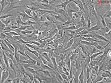 Human Nucleus Pulposus Cells, Passage 1