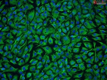 Human Nucleus Pulposus Cells, Passage 1