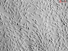 Human Annulus Fibrosus Cells, Passage 1