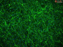 Human Annulus Fibrosus Cells, Passage 1