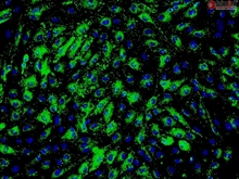 Cryopreserved Human Hepatic Sinusoidal Endothelial Cells, Passage 1, Single Donor