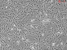 Human Hepatic Stellate Cells, Passage 1