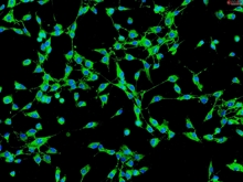 Human Gallbladder Fibroblasts