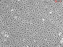 Human Splenic Endothelial Cells, Passage 1