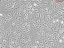 Human Cardiac Microvascular Endothelial Cells, Passage 1, vWF/Factor VIII and CD31 positive 