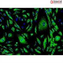 Human Cardiac Microvascular Endothelial Cells, Passage 1, vWF/Factor VIII and CD31 positive 