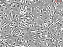 Human Coronary Artery Endothelial Cells, Passage 1