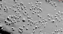 Human Coronary Artery Endothelial Cells, Passage 1