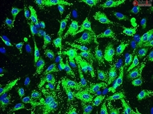 Human Coronary Artery Endothelial Cells, Passage 1