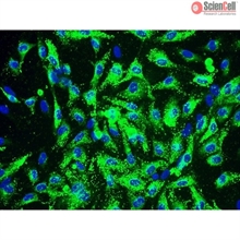 Human Coronary Artery Endothelial Cells, Passage 1