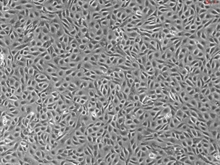 Human Aortic Endothelial Cells, Passage 1