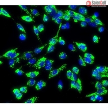 Human Aortic Endothelial Cells, Passage 1