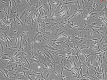 Human Aortic Smooth Muscle Cells, Passage 1