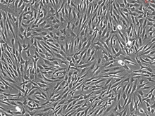 Human Cardiac Myocytes-adult