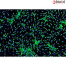 Human Cardiac Myocytes-adult