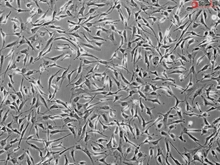 Human Cardiac Fibroblasts