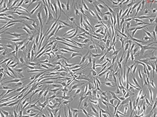 Human Cardiac Fibroblasts - Juvenile ventricular