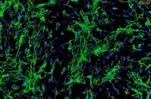 Human Cardiac Fibroblasts - Juvenile ventricular