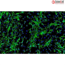 Human Cardiac Fibroblasts - Juvenile ventricular