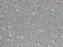 Human Cardiac Fibroblasts - Juvenile atrial