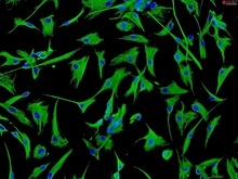 Human Cardiac Fibroblasts - Juvenile atrial