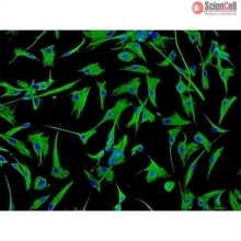 Human Cardiac Fibroblasts - Juvenile atrial