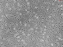 Human Cardiac Fibroblasts-fetal atrial