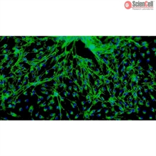 Human Cardiac Fibroblasts-fetal atrial