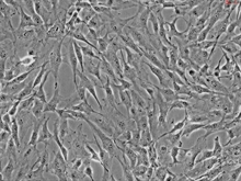 Human Pericardial Fibroblasts