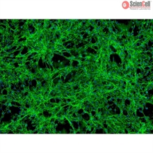 Human Pericardial Fibroblasts